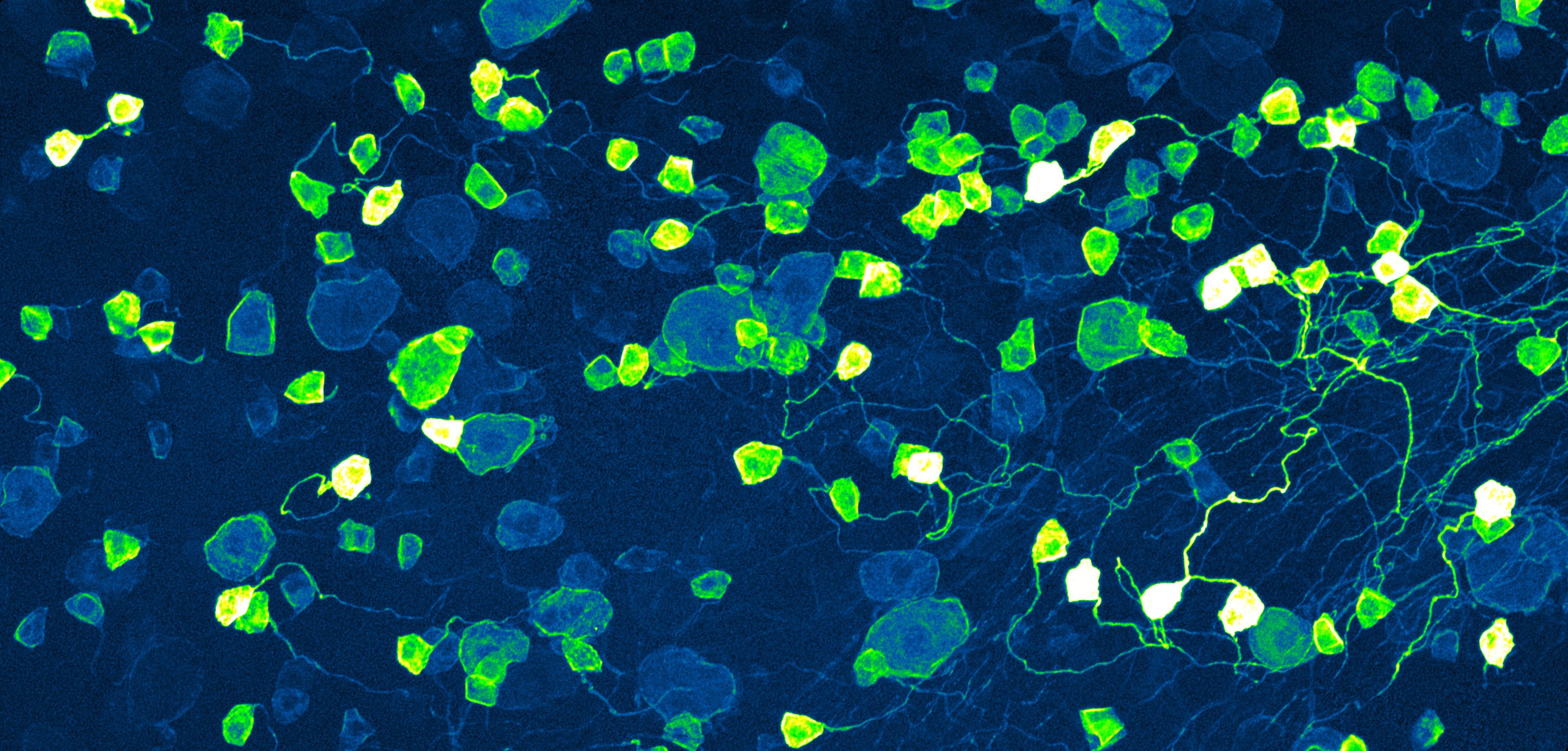 Neurons