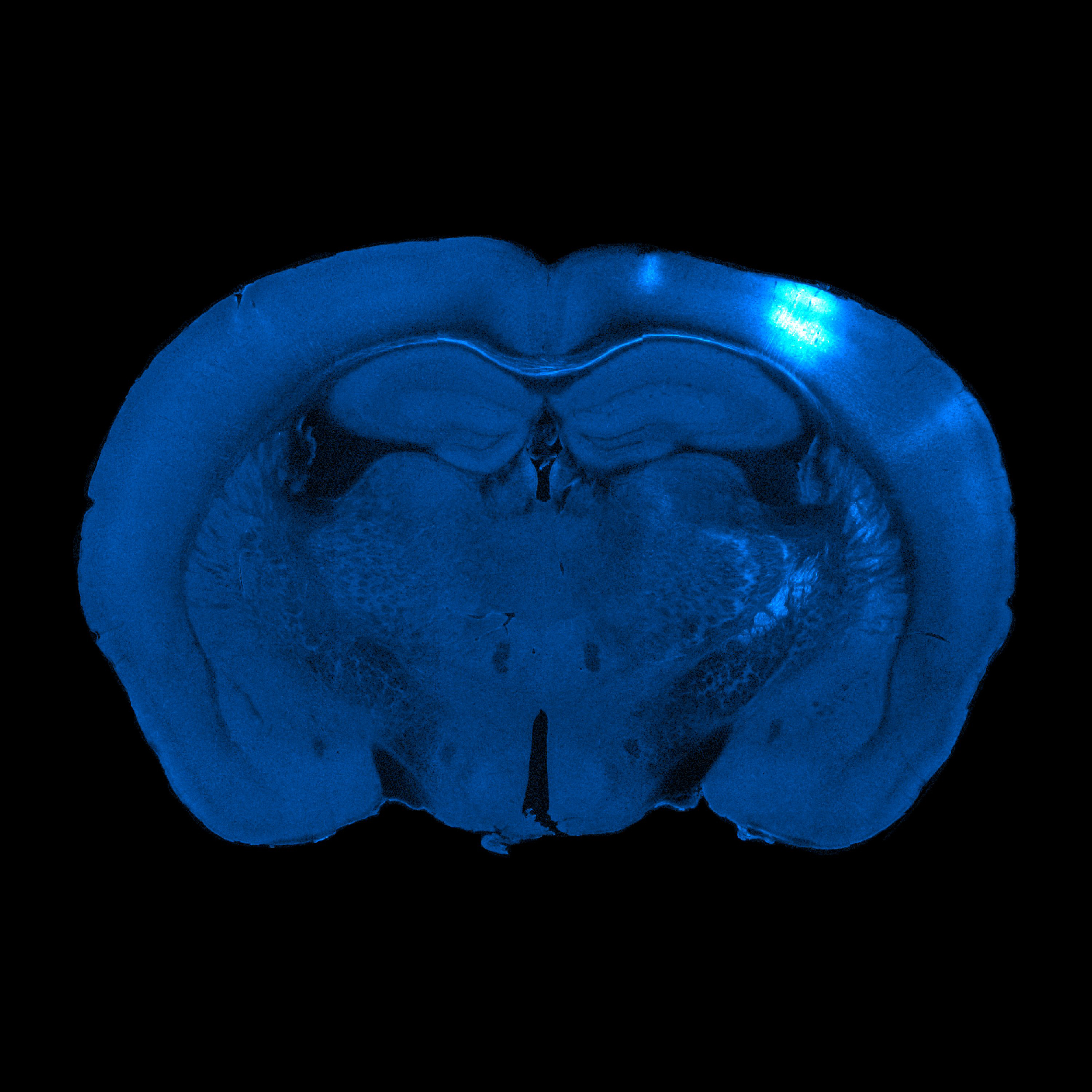 Brain slice